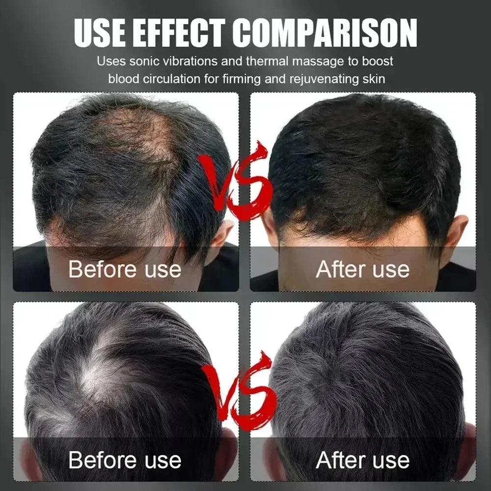 Hair regrowth before and after comparison showing reduced thinning after product use.